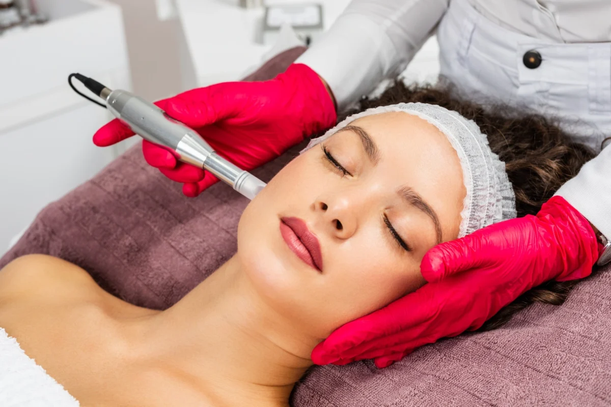 Microneedling with PRP