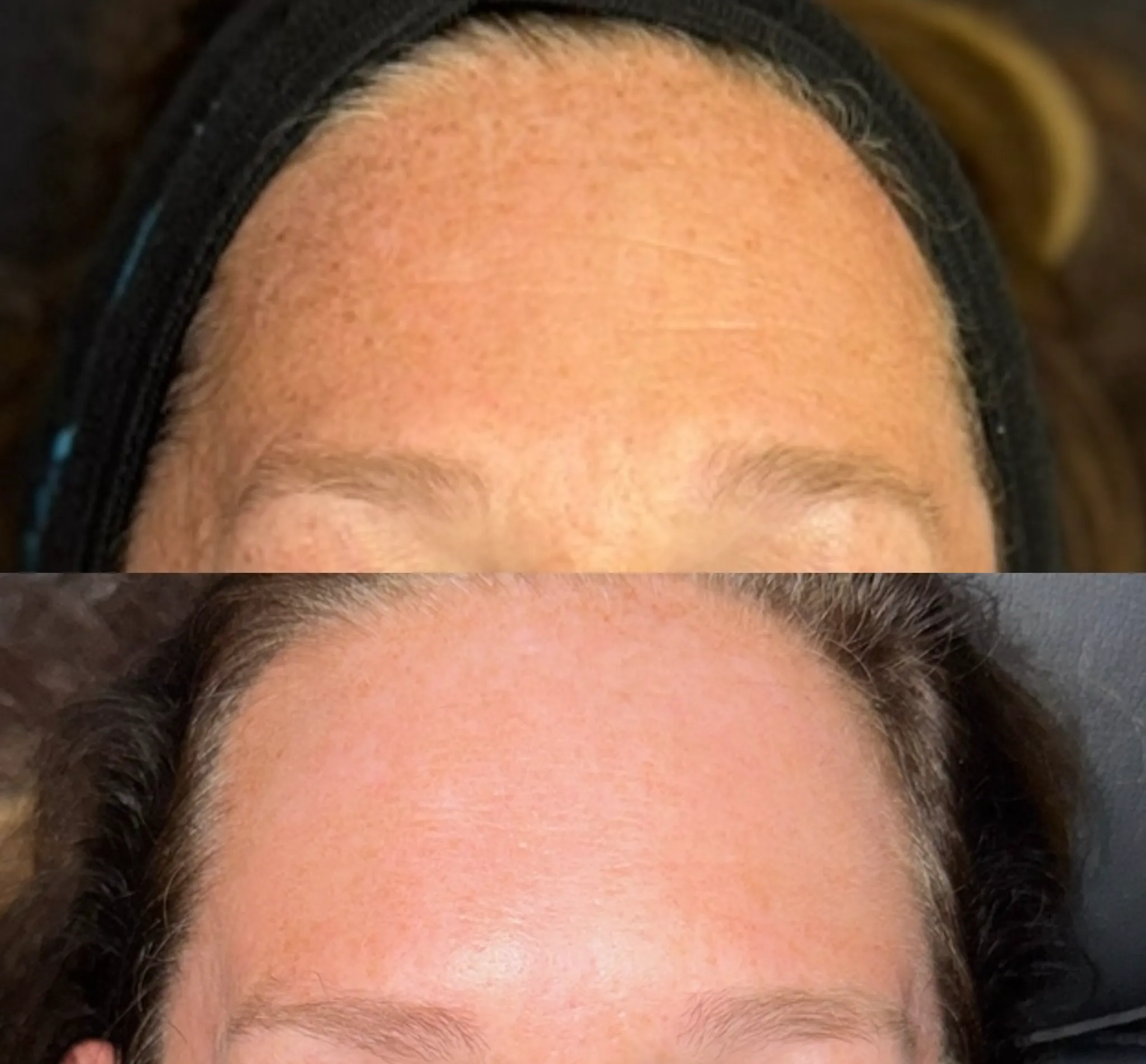 a woman's face with a black headband