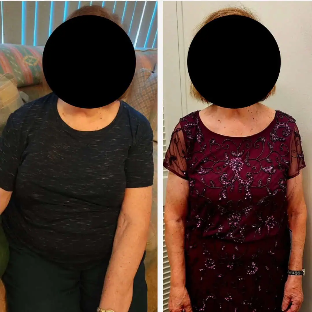 Weight Loss Treatment at Our Little Secret Aesthetics in Fort Myers, FL