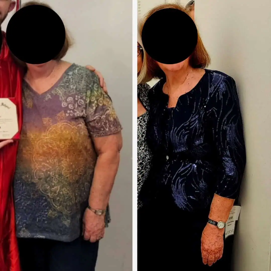 Weight Loss Treatment at Our Little Secret Aesthetics in Fort Myers, FL