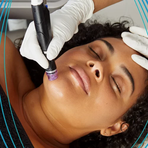 HydraFacial Treatment at Our Little Secret Aesthetics in Fort Myers, FL