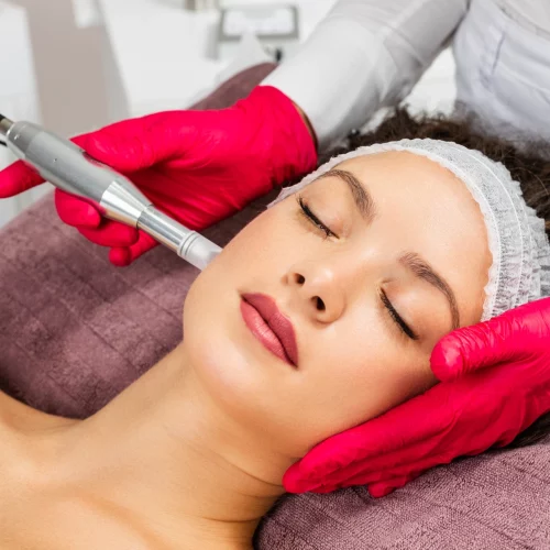 Microneedling with PRP Treatment at Our Little Secret Aesthetics in Fort Myers, FL